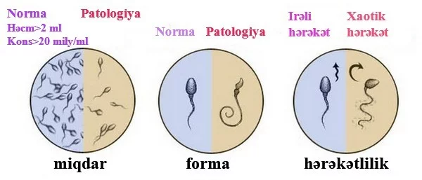 SXEM: Spermoqrammanın əsas göstəriciləri