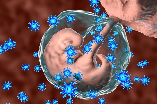 FOTO: Sitomeqalovirus cift vasitəsilə anadan dölə keçə bilər