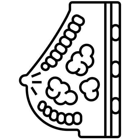 Süd vəzi xəstəlikləri