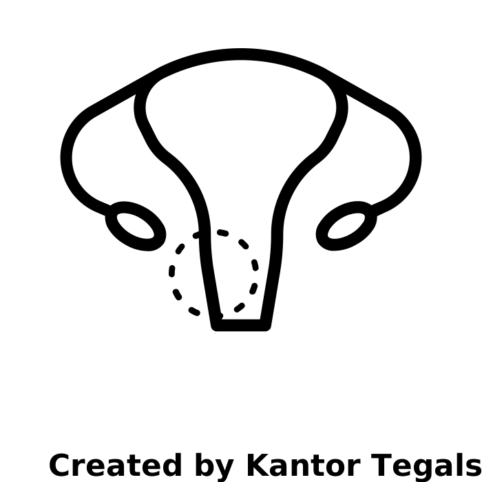 Ginekoloji şişlər və hiperplaziyalar